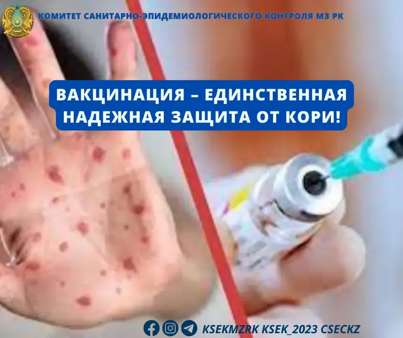 Эффективная защита от кори: вакцинация остается единственным надежным методом Актобе