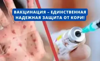 Эффективная защита от кори: вакцинация остается единственным надежным методом