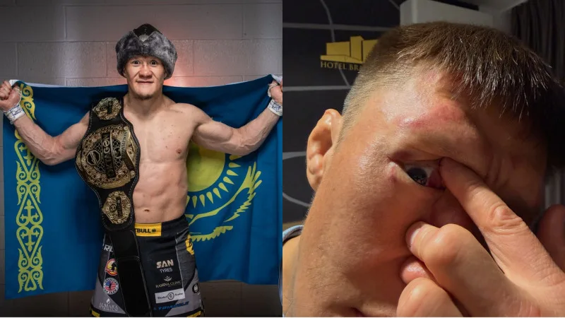 Жалгас Жумагулов: "Больше не буду драться" - чемпион OKTAGON о последствиях скандального боя Актобе