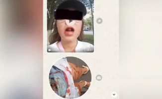 Велосипедист сбил 12-летнюю девочку и уехал с места происшествия: призыв к очевидцам для установления виновного